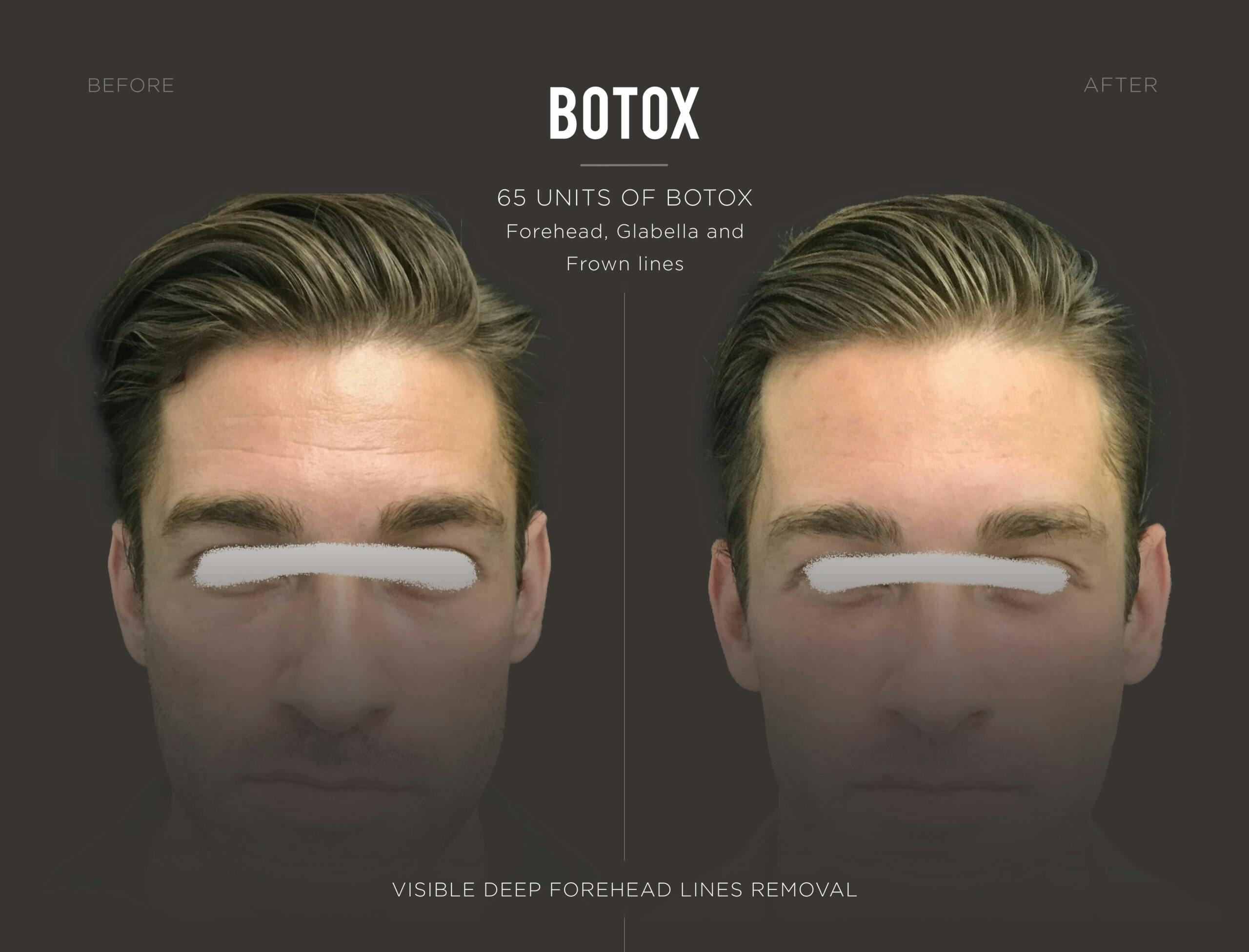 botox-great-results-trifecta-med-spa-scaled.jpg