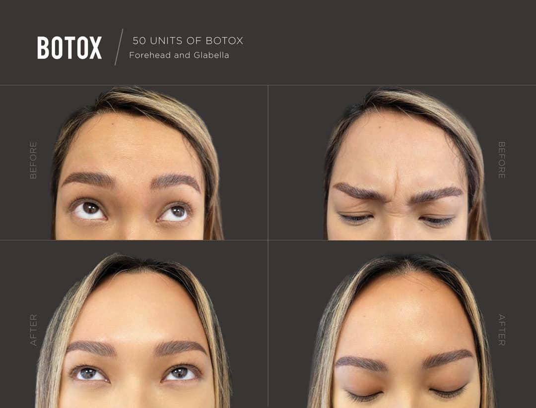 Before After Photos - Trifecta Med Spa