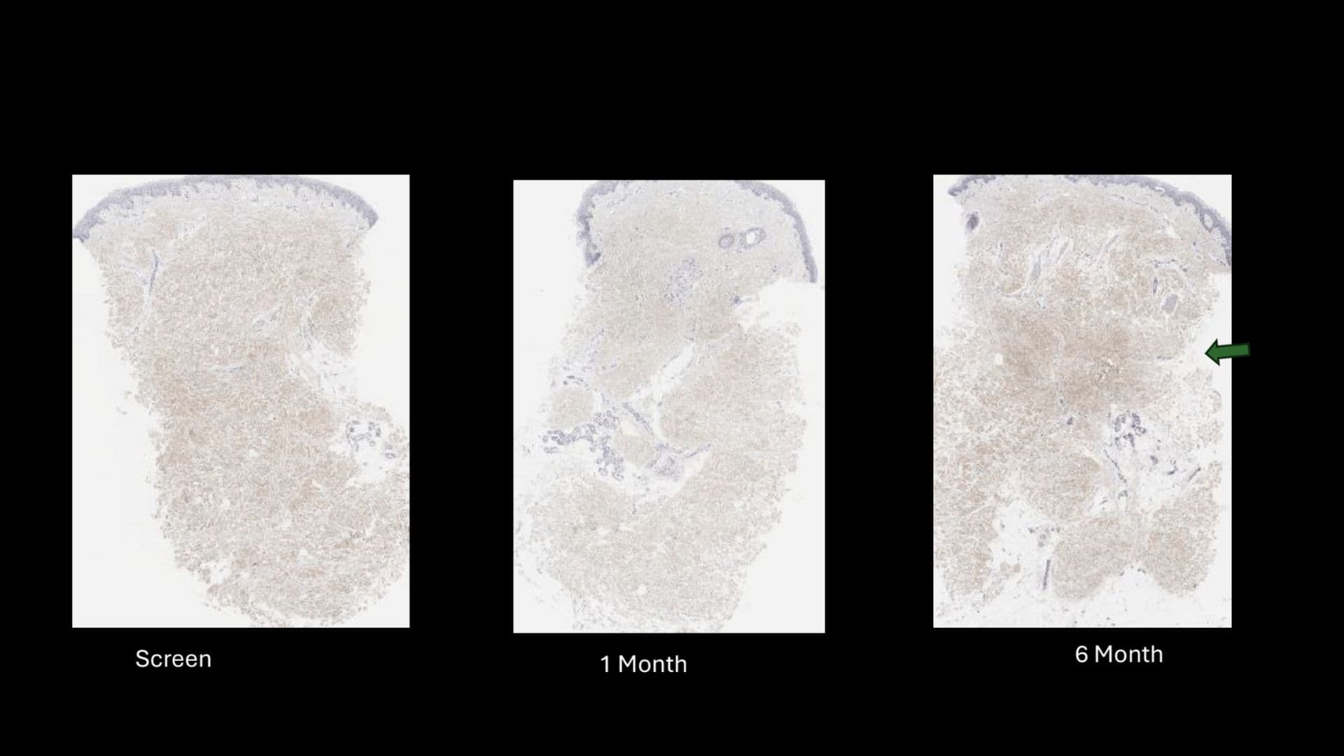 Baseline illustration