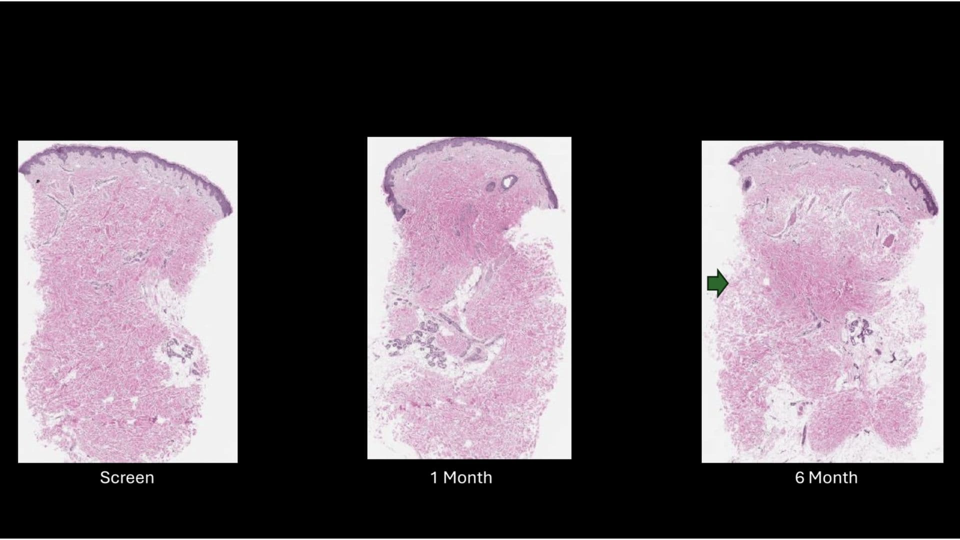 6-month results illustration