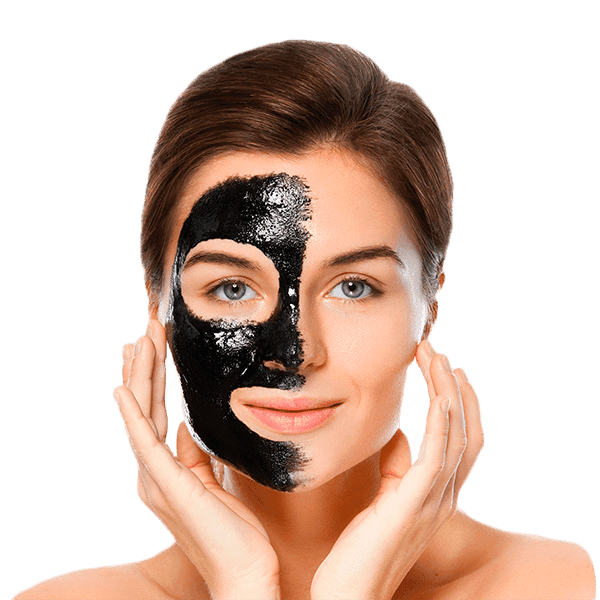 Carbon Laser Facial Treatment at Trifecta Med Spa NYC