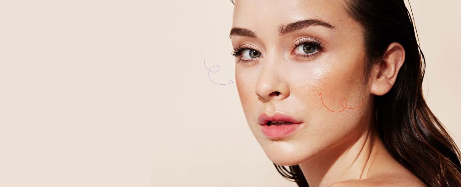 Facial treatment areas for SKINVIVE at Trifecta Med Spa NYC