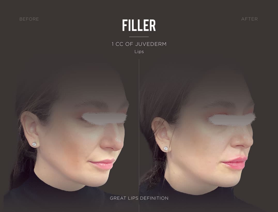 Subtle Lip Border Definition
