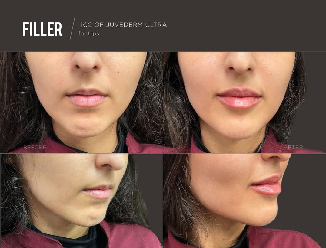 Hydrated Plump Lip Contour