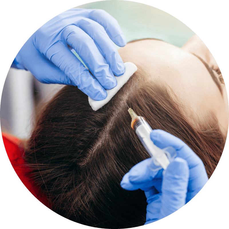 GOODBYE HAIR LOSS