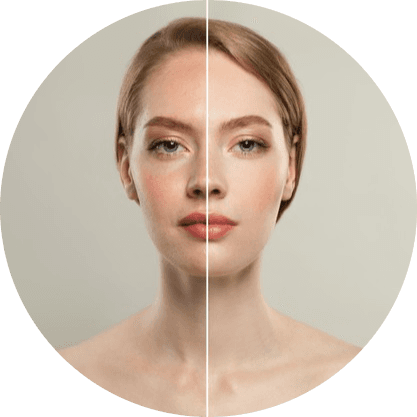 Unwanted Lesions, Be Gone!