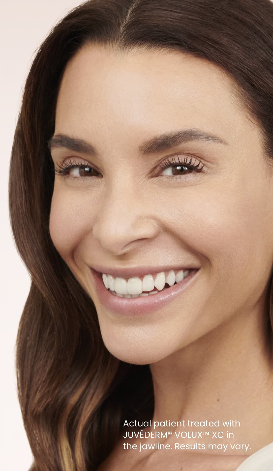 Juvederm Volux NYC