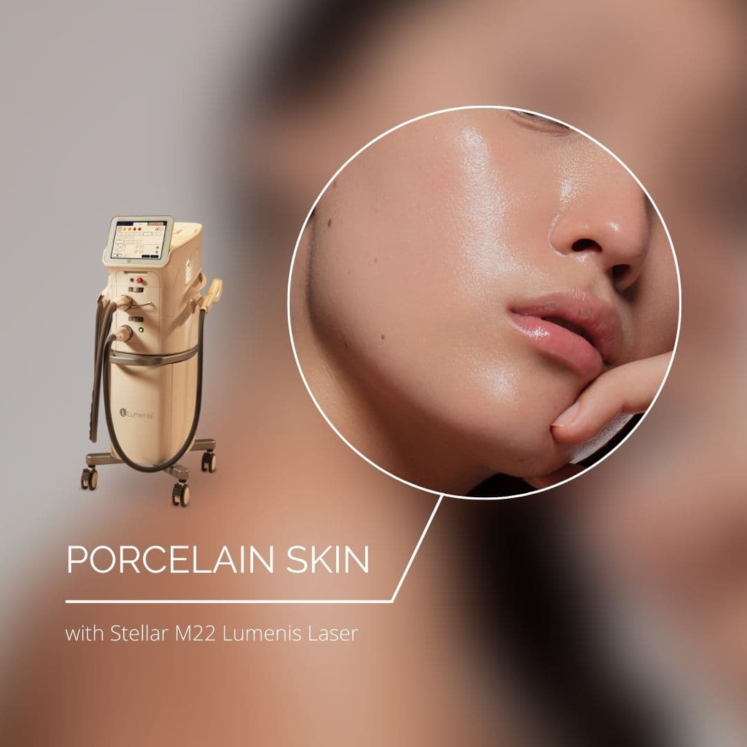 Porcelain Skin Photofacial NYC